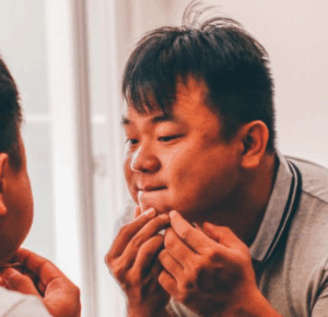 Read more about the article 턱 여드름의 원인 치료 방법 예방 방법